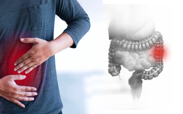 Colorectal Surgery